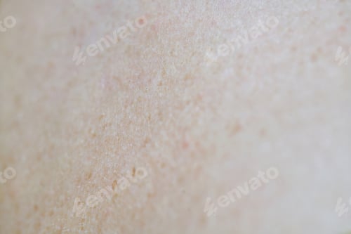 Preview: Skin Texture