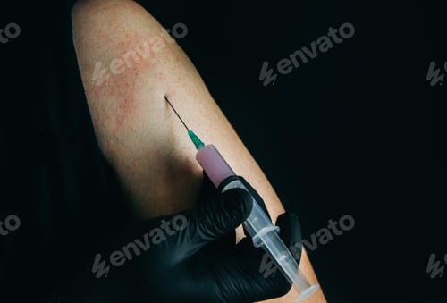 Preview: Man Is Getting An Injection. Medical Treatment Of A Low Quality. Black Gloves. Syringe With Drugs.