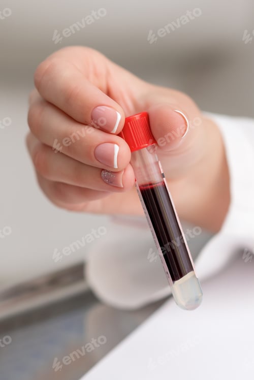 Preview: Close Up Of Hand Of Doctor Holding Test Tube With Blood In The Lab.