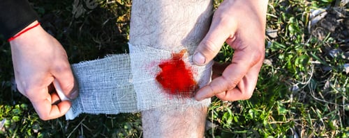 Preview: Man Is Putting Bandage On Bleeding Wound. Injured Leg. Tourist In The Nature. Infection Danger