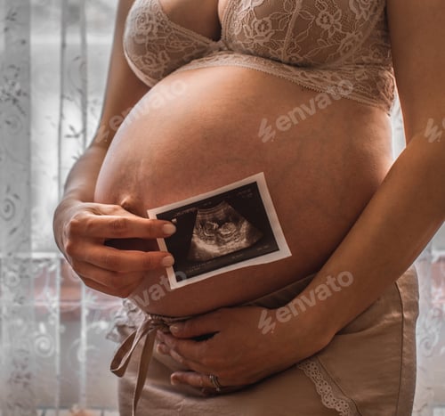 Preview: Close Up Pregnant Woman Feeling Happy Love At Home While Looking Of Her Ultrasonography. The Young