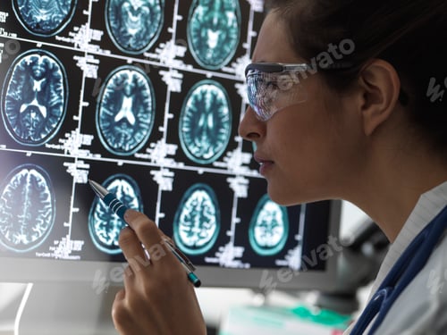 Preview: A focused healthcare professional analyzing MRI brain scans.