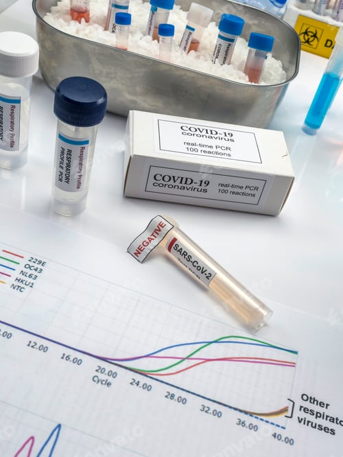 Preview: Novel coronavirus 2019 nCoV pcr diagnostics kit