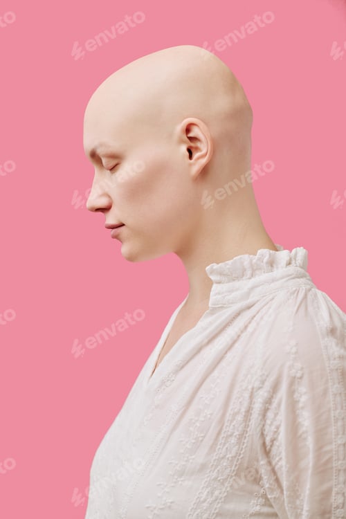 Preview: Young Adult Woman with Alopecia Standing in Profile Against Pink Background
