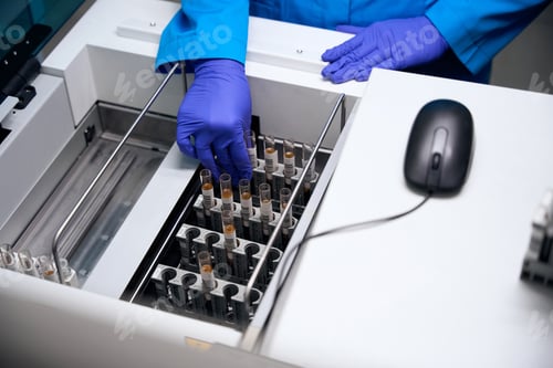 Preview: Set with test tubes with biomaterial for general urine analysis