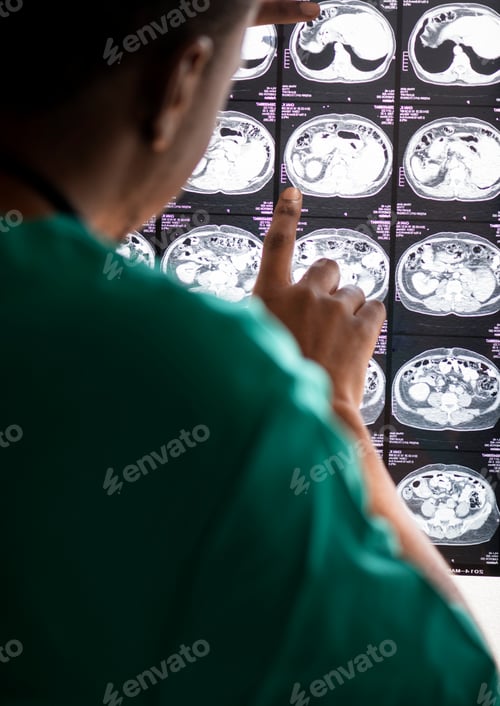 Preview: Doctor reading brain MRI x-ray result