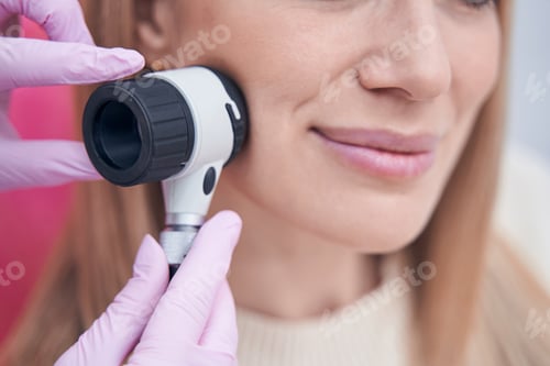 Preview: Dermatologist using dermoscopy device during patient skin check
