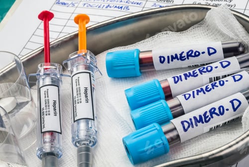 Preview: heparin medication for covid-19 patients with elevated blood dimero-D
