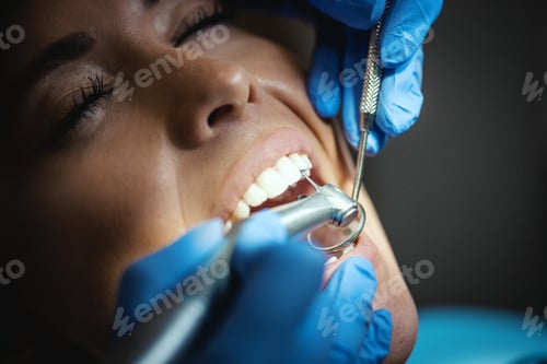 Preview: Making Perfect Smile
