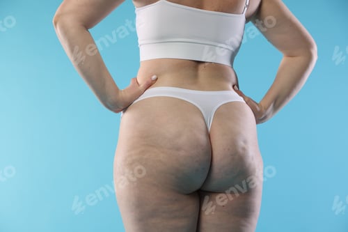 Preview: Woman with cellulite on light blue background, closeup