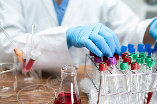 Preview: Scientist holding and analysis tube of micro biological sample outbreak Coronavirus