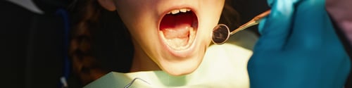 Preview: Inspecting Child's Mouth During Dental Examination