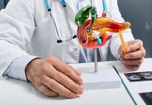 Preview: Treatment of pancreatic diseases, acute and chronic pancreatitis. Doctor showing pancreatic disease