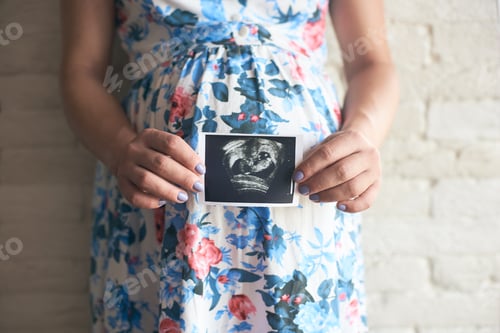 Preview: Pregnant woman showing ultrasound image of baby