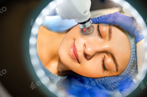 Preview: Face Having A Laser Skin Treatment, A Resurfacing Technique For Wrinkles