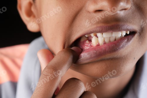 Preview: child smiling with deformed teeth
