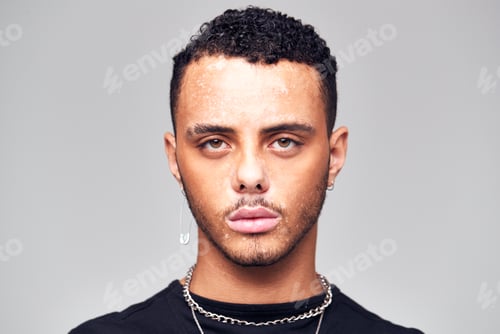 Preview: Studio Portrait Of Young Man With Skin Pigmentation Disorder Looking At Camera