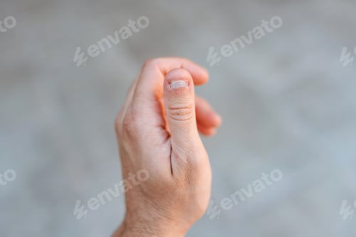Preview: Close up detail of a left hand showing a thumb with a white and bitten nail condition