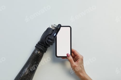 Preview: Girl with prosthetic arm using mobile phone