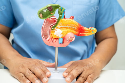 Preview: Pancreatitis, pancreatic cancer, Asian doctor with pancreas, gallbladder