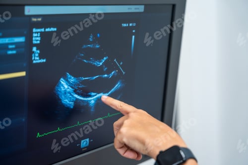 Preview: Cardiology clinic with a new ultrasound machine for echocardiogram exams to clients