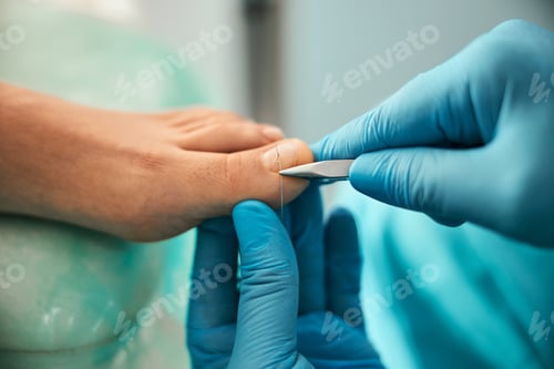 Preview: Beautiful female leg on medical chair while chiropodist using special tools for treatment toes