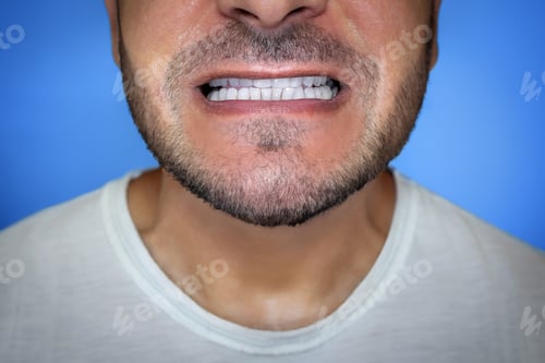Preview: Close-up of a man's mouth, after teeth care.