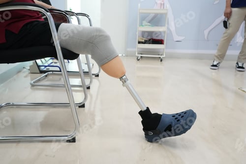 Preview: Unrecognizable disabilities on prosthetic leg.