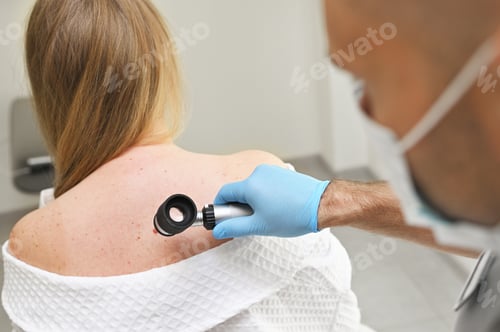 Preview: dermatologist examines neoplasms on the patient's skin using a special dermatoscope device