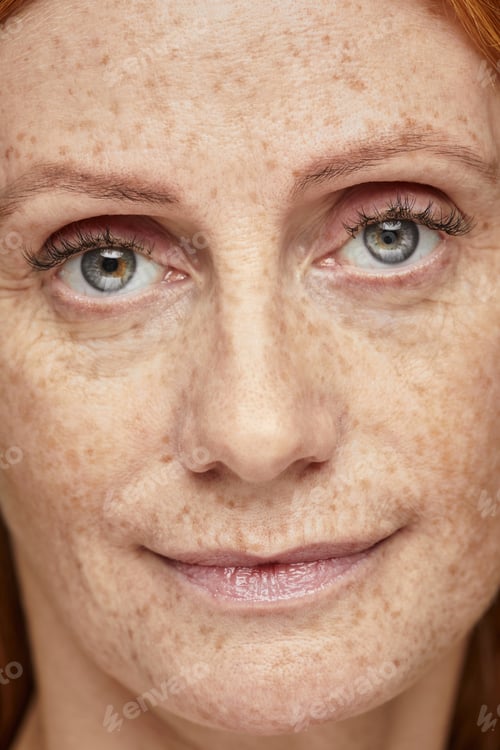 Preview: Freckled Woman No Makeup