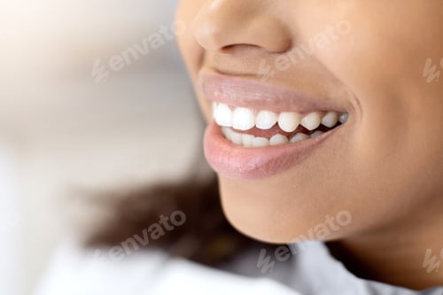 Preview: Teeth Whitening Concept. Closeup Of Beautiful Young African American Woman Widely Smiling