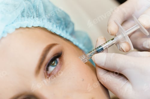 Preview: Symmetric cheekbone filler enhancement designed for balanced facial features.