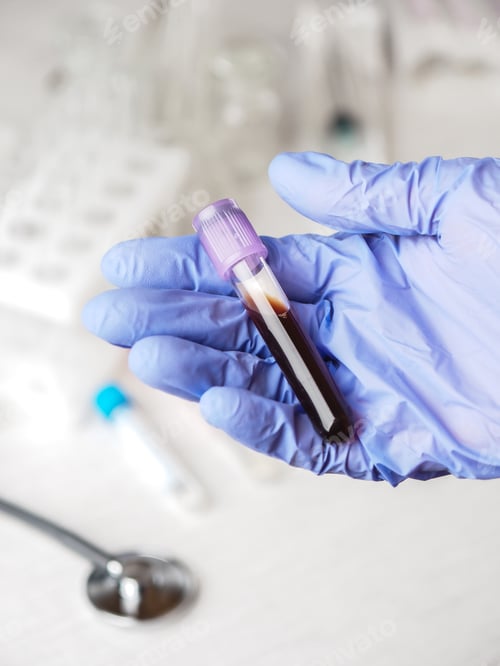 Preview: Hand in medical glove holding a test tube
