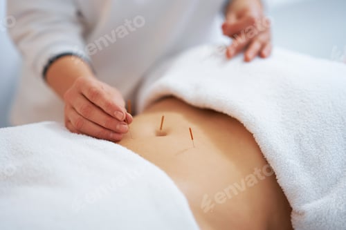 Preview: A acupuncture needle therapy in the studio