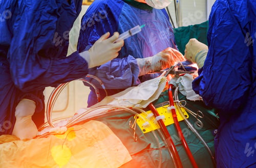 Preview: Surgeon hands are tying a knot during the open heart procedure chest during heart surgery