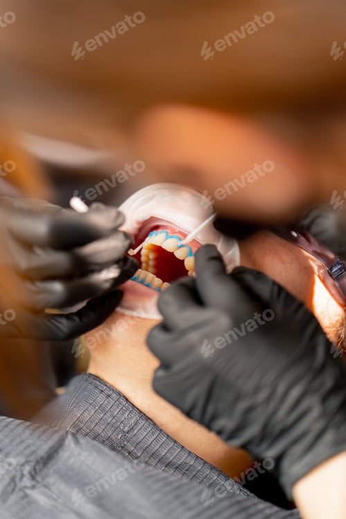 Preview: close up dental office girl dentist applies protective gel to the gums of young guy