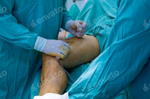 Preview: Surgeons Suture During Surgery in a Hospital