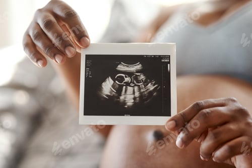 Preview: Closeup shot of an unrecognisable woman holding a sonogram at home
