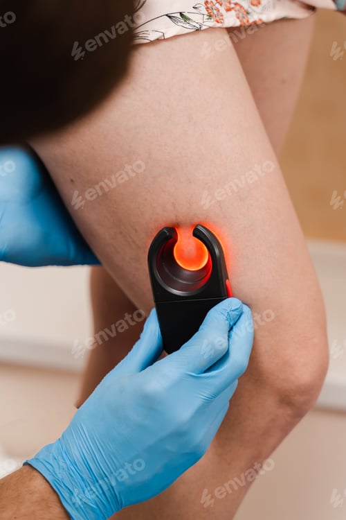 Preview: Infrared vein scanner detects subcutaneous veins for accurate varicose vein mapping