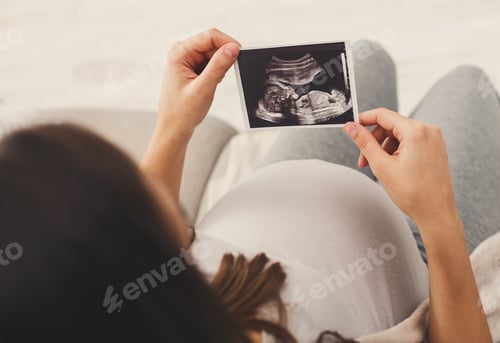 Preview: Pregnant woman looking at her baby sonography