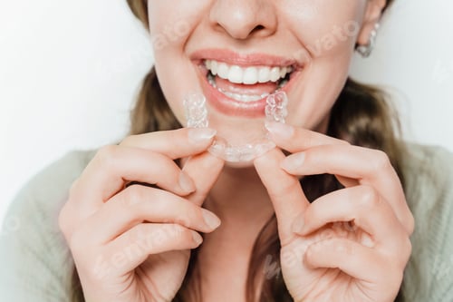 Preview: Smiling Woman Holding Clear Teeth Aligner