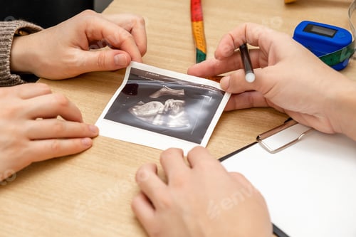 Preview: Doctor and pregnant patient are looking at an ultrasound picture in a medical office,hands close-up.