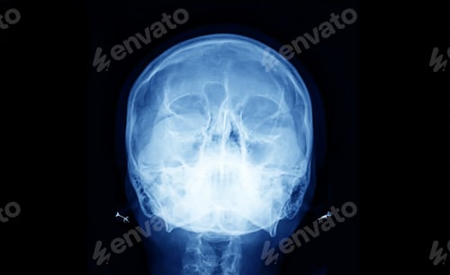 Preview: X-Ray film scan of human.