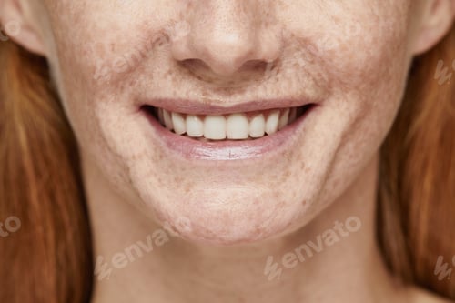 Preview: Beautiful Natural Smile Close Up