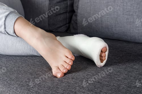 Preview: Close up of a leg young girl fiberglass.