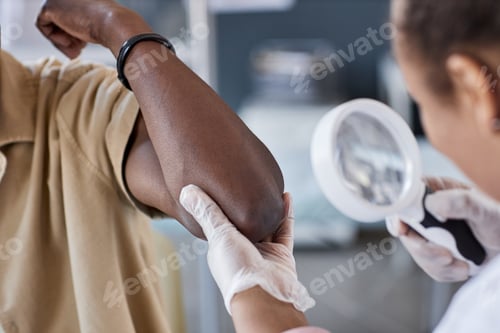 Preview: Closeup of Dermatologist Examining Skin