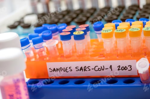 Preview: Vials with samples of SARS-COV-1 prepared cold in a laboratory