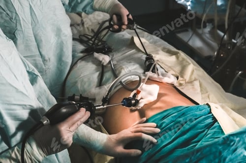 Preview: Medicine.Surgeon doctor makes laparoscopy operation.Modern medicine,close-up,operating room.Doctor