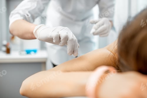 Preview: Acupuncture medical treatment