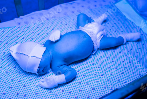 Preview: Newborn having a treatment for jaundice under ultraviolet lamp in home bed